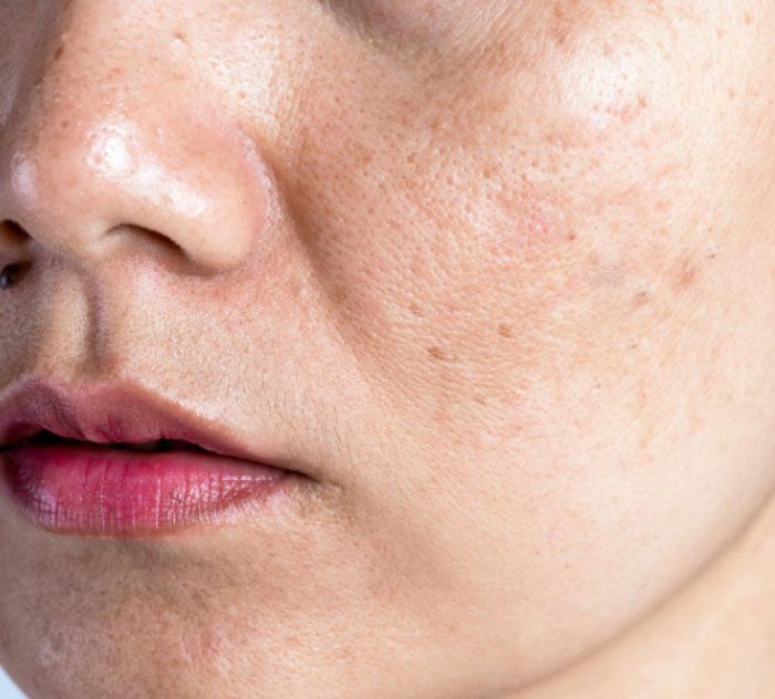 Damaged_Skin (1)